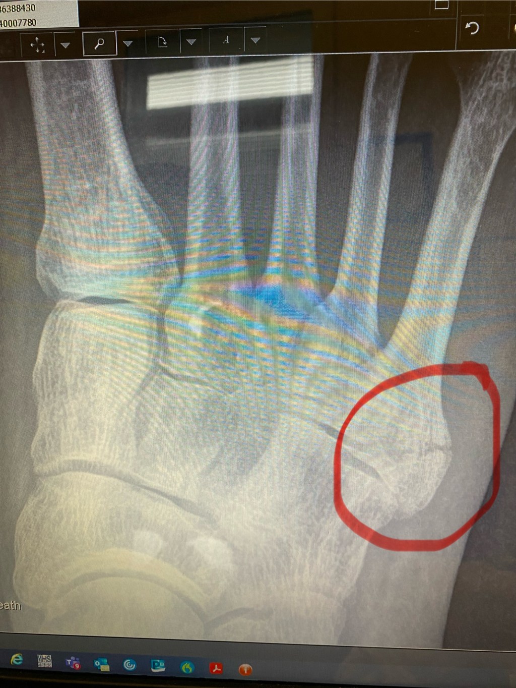 A SHATTERED SKI&nbsp;TRIP